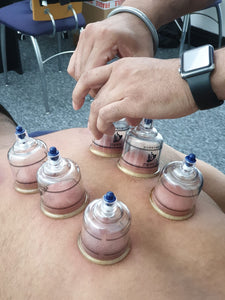 Cupping Therapy